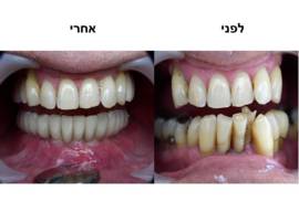 השוואה